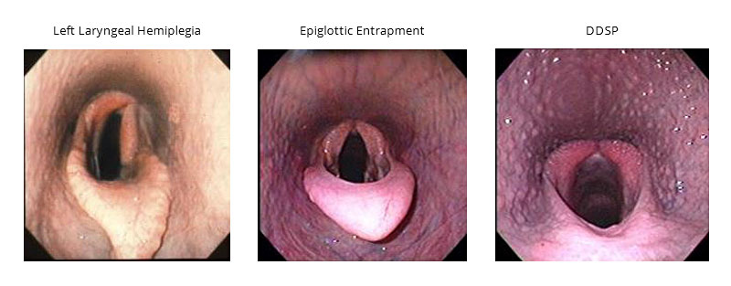 endoscopy-img2