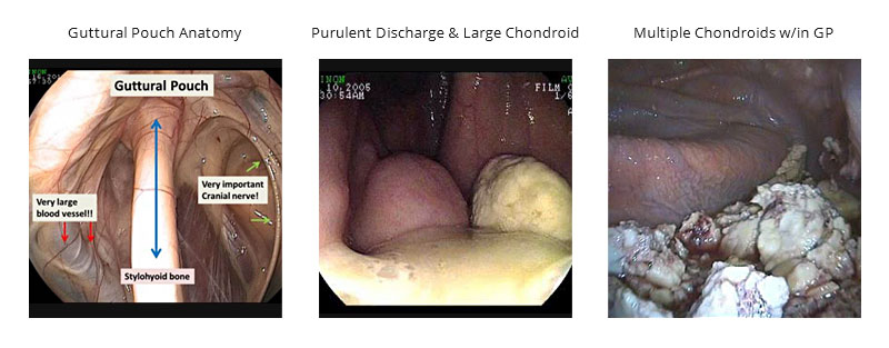 endoscopy-img3